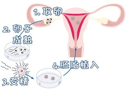 专家